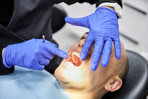 Best Emergency Dentist for Knocked-Out Tooth in Palm Bay, FL